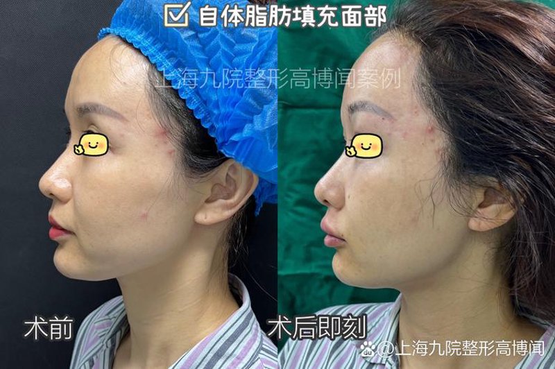 聚焦北京医疗美容医院：美与健康的和谐篇章